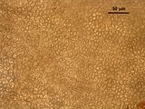 3 - Cellule corticali in visione superficiale